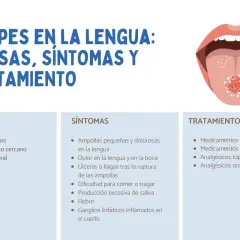 Ilustración de una boca abierta mostrando herpes en la lengua, con información sobre causas, síntomas y tratamiento.