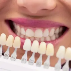Comparación de tonos para una dentadura de zirconio perfecta.