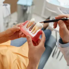Dentista explica modelo de implante dental. Conoce qué no se puede hacer después de un implante dental para asegurar su éxito.