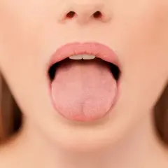 Primer plano de una boca abierta mostrando la lengua, con una leve herida en la lengua por mordisco visible.