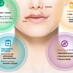El herpes labial, con sus causas como el estrés y el sol, evoluciona de picor a vesículas y costras.