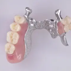 Prótesis esquelética superior con dientes de resina y estructura metálica.