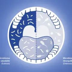 Boca dividida: izquierda, microbioma saludable con bacterias beneficiosas; derecha, microbioma desequilibrado. ¿Cuánto tiempo usar clorhexidina?