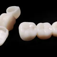 Prótesis dentales de bopt dental, un puente de tres coronas y una corona individual, sobre fondo negro.