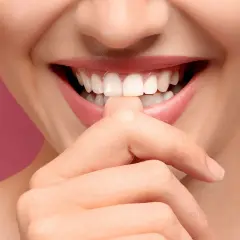 Sonrisa radiante con dientes blancos y perfectos. Incluso se puede blanquear un implante dental para lograr este resultado.