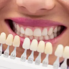 Una persona sonríe mostrando una guía de colores para **dientes de porcelana**, eligiendo el tono perfecto para un nuevo look.