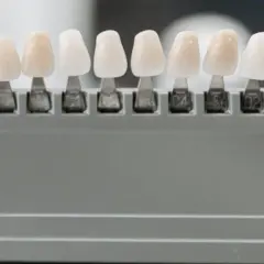 Muestras de dientes de diferentes tonos, para elegir el color perfecto y evitar la enfermedad de los dientes que se caen.