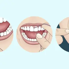 Ilustración muestra cómo usar hilo dental para limpiar entre los dientes. El hilo dental para que sirve es eliminar restos de comida y placa.