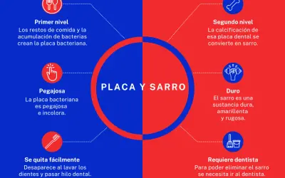 Placa bacteriana pegajosa que, si no se eliminan los restos de comida y se dejan los dientes sin lavar, se calcifica y se convierte en sarro duro.