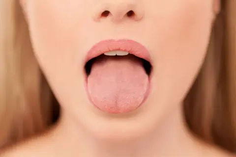 Primer plano de una boca abierta mostrando la lengua, con una leve herida en la lengua por mordisco visible.
