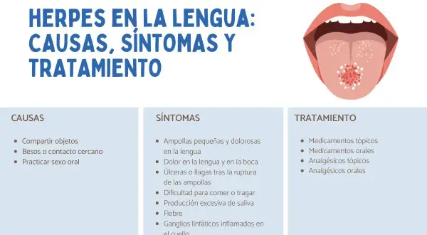 Ilustración de una boca abierta mostrando herpes en la lengua, con información sobre causas, síntomas y tratamiento.