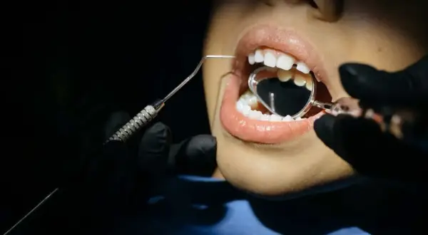 Revisión dental: se me ha roto una muela pero no me duele. El dentista usa un espejo para examinar mi boca.
