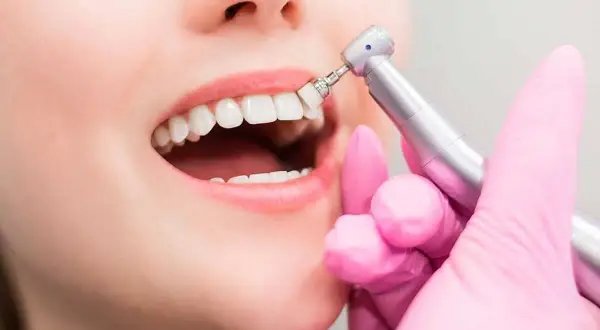 Una mano con guante rosa realiza una limpieza profunda de encías con un pulidor dental.