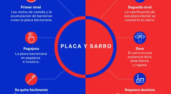 Placa bacteriana pegajosa que, si no se eliminan los restos de comida y se dejan los dientes sin lavar, se calcifica y se convierte en sarro duro.