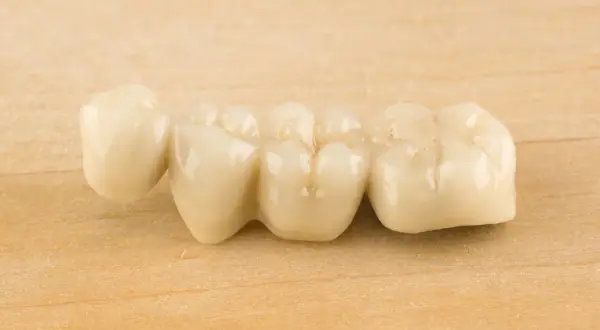 Puente dental de porcelana sobre fondo de madera. Podría causar dolor en puente dental al masticar si no está bien ajustado.
