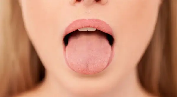 Primer plano de una boca abierta mostrando la lengua, con una leve herida en la lengua por mordisco visible.
