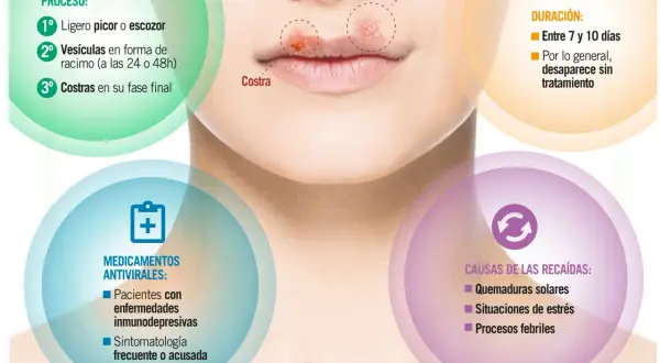 El herpes labial, con sus causas como el estrés y el sol, evoluciona de picor a vesículas y costras.