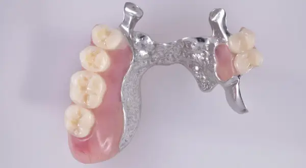 Prótesis esquelética superior con dientes de resina y estructura metálica.