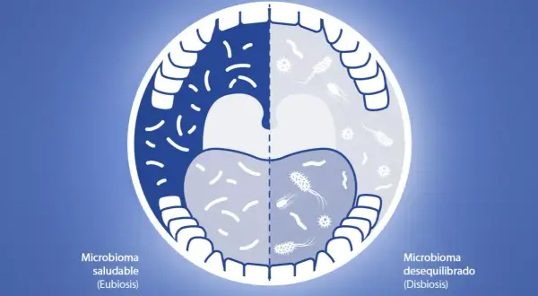 Boca dividida: izquierda, microbioma saludable con bacterias beneficiosas; derecha, microbioma desequilibrado. ¿Cuánto tiempo usar clorhexidina?