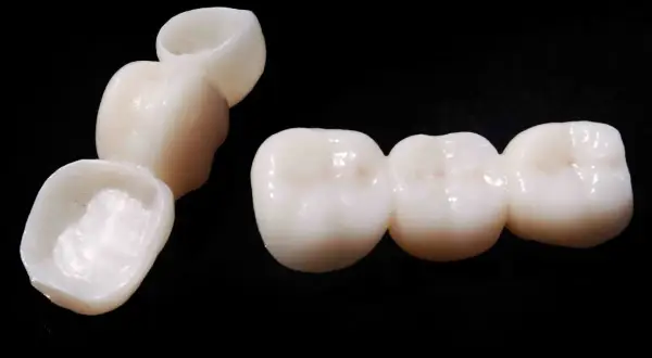 Prótesis dentales de bopt dental, un puente de tres coronas y una corona individual, sobre fondo negro.