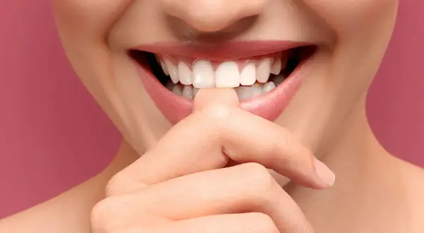 Sonrisa radiante con dientes blancos y perfectos. Incluso se puede blanquear un implante dental para lograr este resultado.