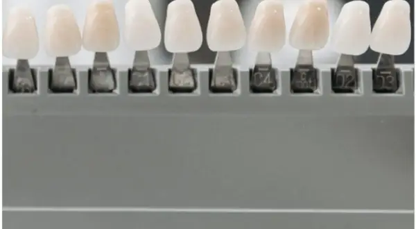 Muestras de dientes de diferentes tonos, para elegir el color perfecto y evitar la enfermedad de los dientes que se caen.
