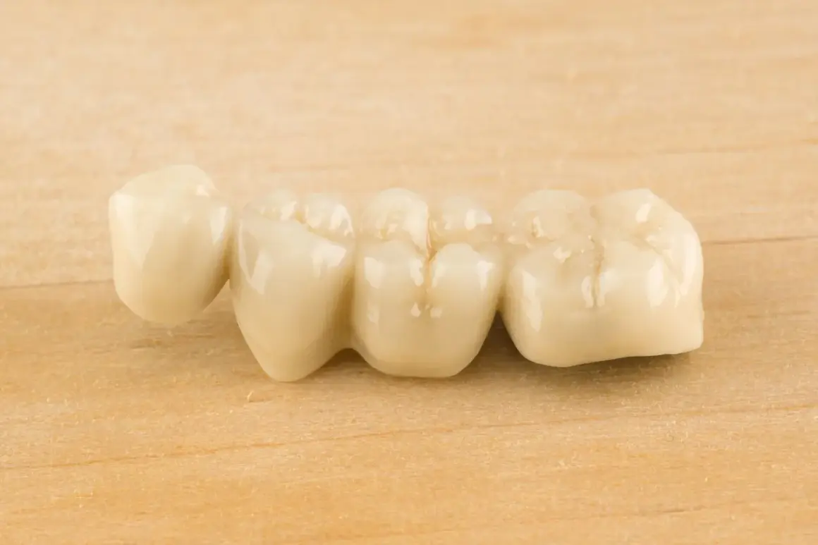 Puente dental de porcelana sobre fondo de madera. Podría causar dolor en puente dental al masticar si no está bien ajustado.