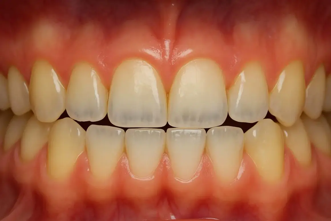 Vista frontal de una boca con dientes sanos y encías rosadas. Se aprecian los incisivos y caninos superiores e inferiores, mostrando una dentadura completa y sin signos de dientes porosos.