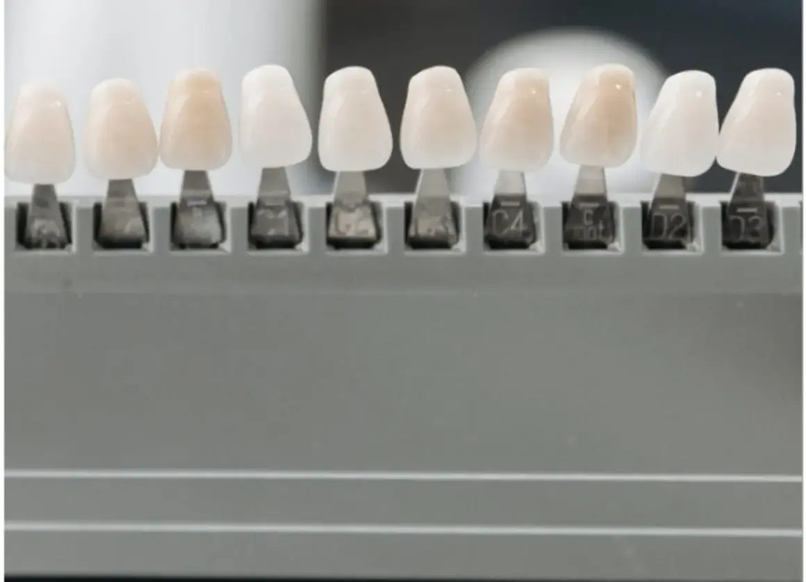 Muestras de dientes de diferentes tonos, para elegir el color perfecto y evitar la enfermedad de los dientes que se caen.