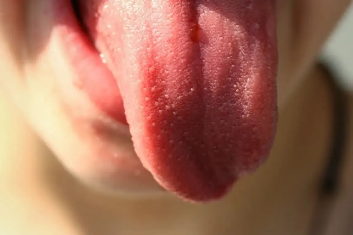 Lengua rosada y húmeda, con una pequeña cicatriz en la lengua que apenas se nota entre las papilas gustativas.