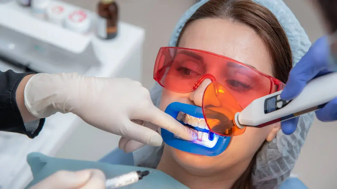 Paciente con gafas protectoras rojas recibe tratamiento de limpieza de dientes con luz azul.