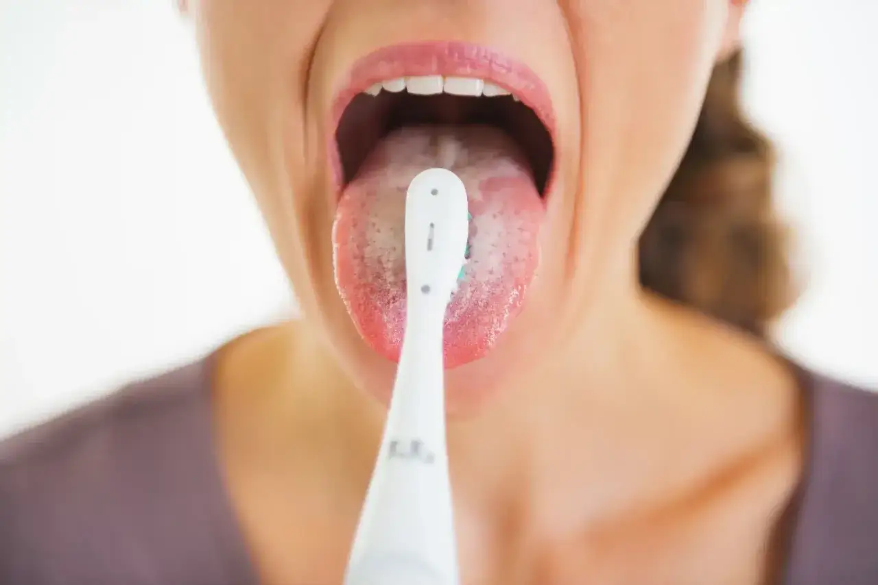 Una persona se cepilla la lengua, que tiene una capa blanca.