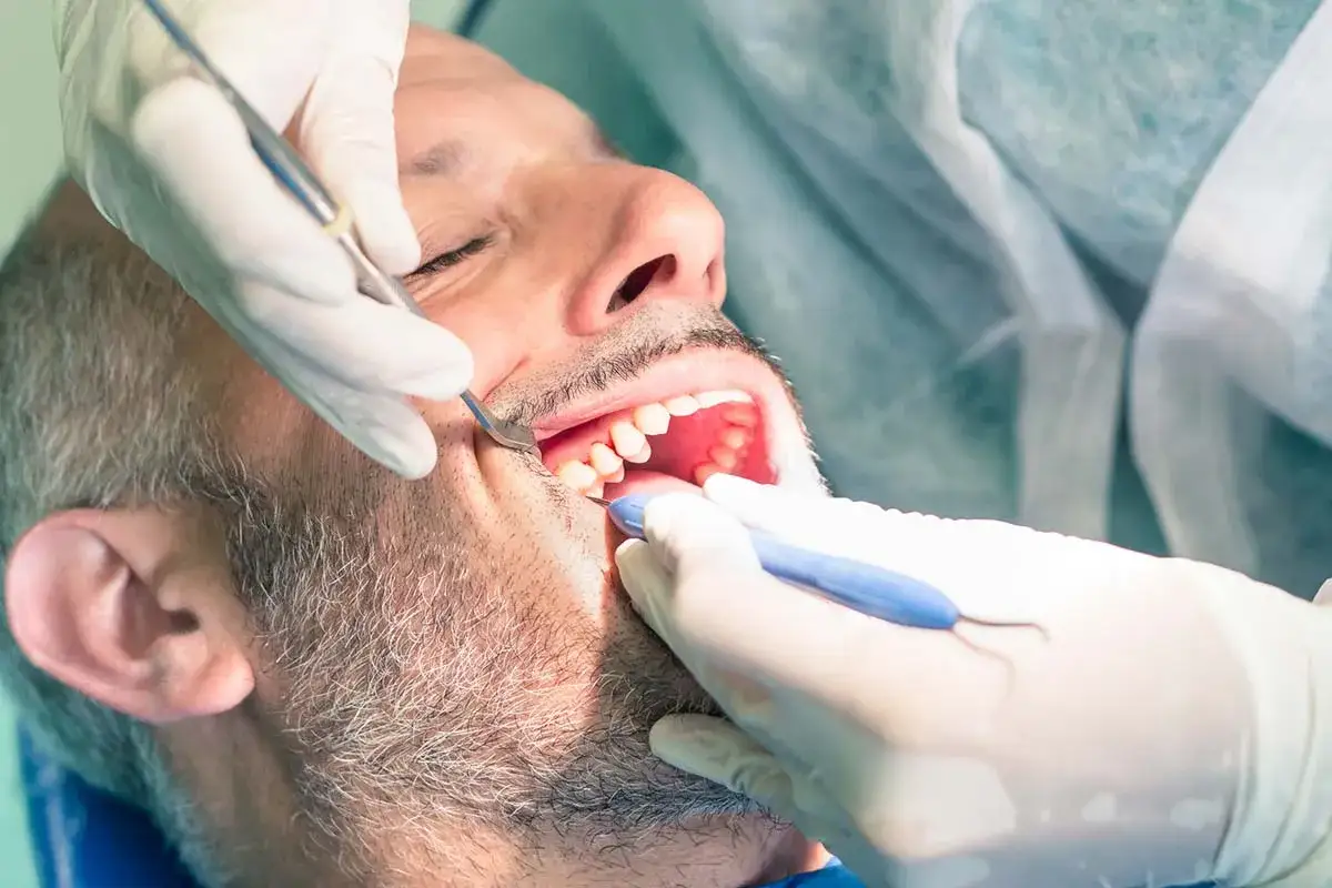 Dentista examina la boca de un hombre. El paciente parece incómodo, quizás por un procedimiento como la elevación de seno maxilar que duele.
