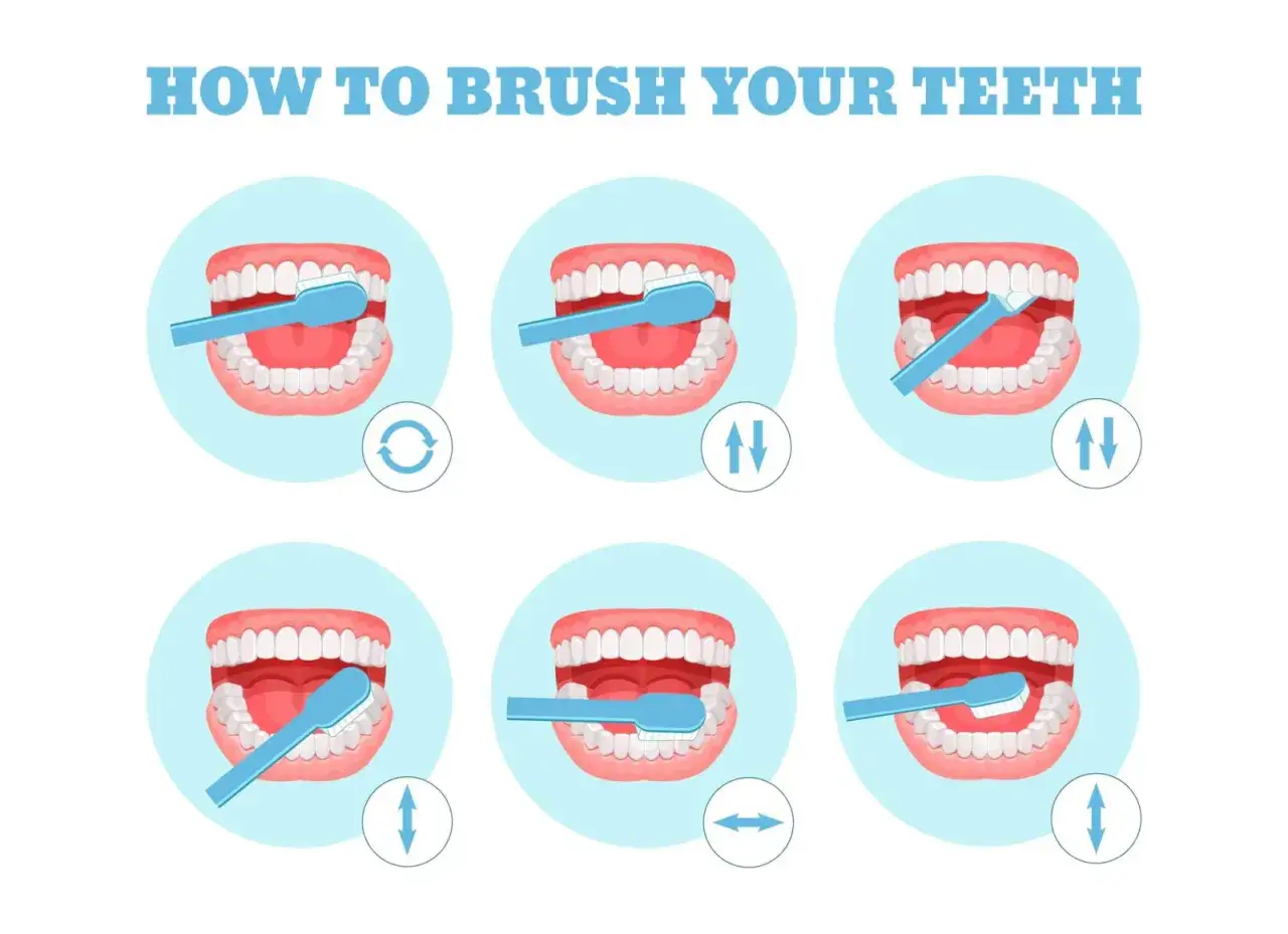 Ilustración muestra seis pasos para lavarse los dientes correctamente, con una boca abierta y un cepillo azul.