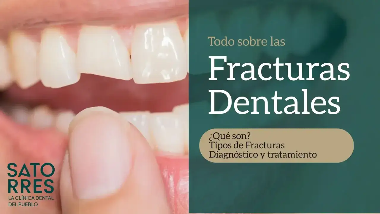 Primer plano de una boca mostrando un diente roto. El texto dice 