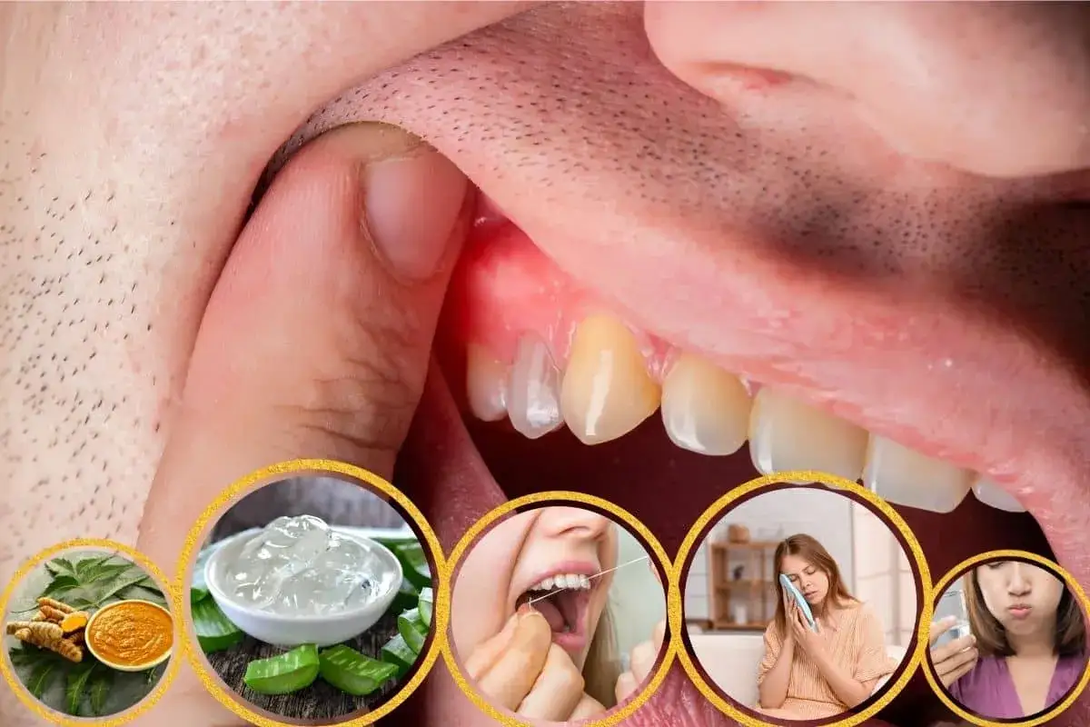 Remedio natural para enc&iacute;as inflamadas: agua con sal, aloe vera y c&uacute;rcuma. Alivio para el dolor de enc&iacute;as.