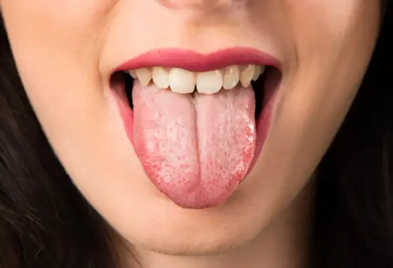 Ansiedad en la Boca y Lengua - Síntomas, Causas y Alivio
