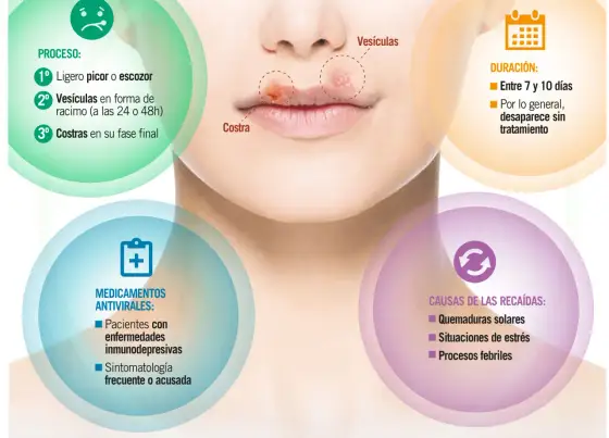 Herpes labial: Desencadenantes y cómo actuar a tiempo