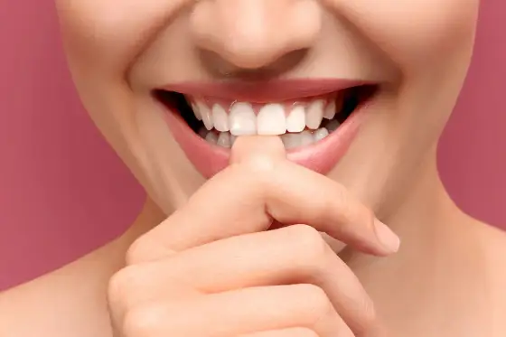 ¿Blanquear implante dental? Descubre por qué no y qué hacer.