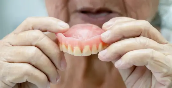 Arcada Dental - ¿Por qué se pica y cómo protegerla?