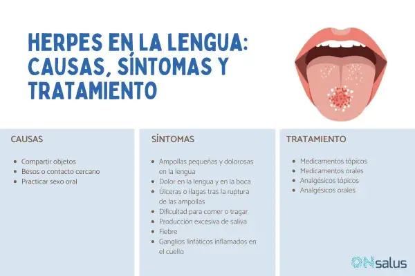 Ilustración de una boca abierta mostrando herpes en la lengua, con información sobre causas, síntomas y tratamiento.