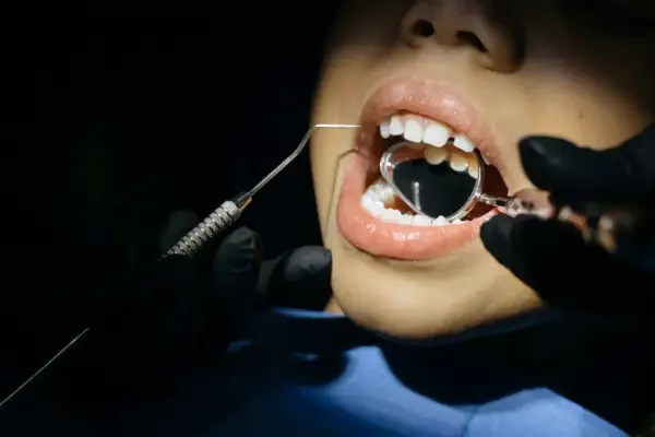 Revisión dental: se me ha roto una muela pero no me duele. El dentista usa un espejo para examinar mi boca.