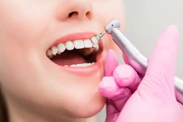 Una mano con guante rosa realiza una limpieza profunda de encías con un pulidor dental.