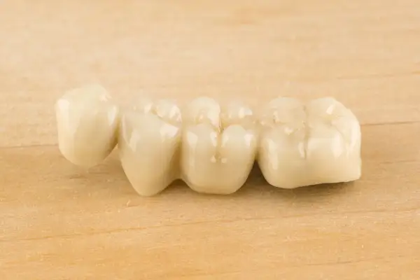 Puente dental de porcelana sobre fondo de madera. Podría causar dolor en puente dental al masticar si no está bien ajustado.