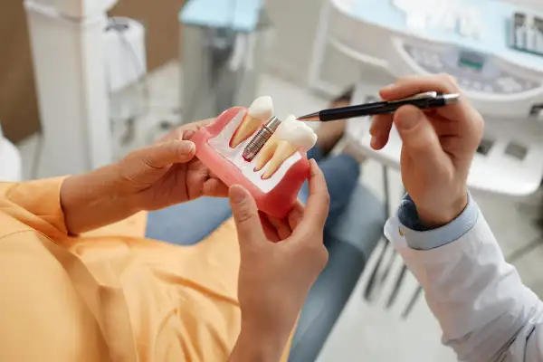 Dentista explica modelo de implante dental. Conoce qué no se puede hacer después de un implante dental para asegurar su éxito.
