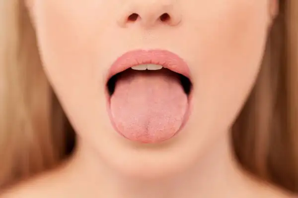 Primer plano de una boca abierta mostrando la lengua, con una leve herida en la lengua por mordisco visible.