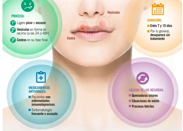 El herpes labial, con sus causas como el estrés y el sol, evoluciona de picor a vesículas y costras.