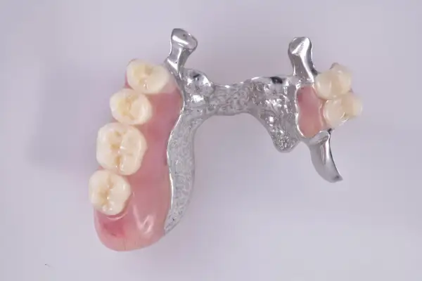 Prótesis esquelética superior con dientes de resina y estructura metálica.