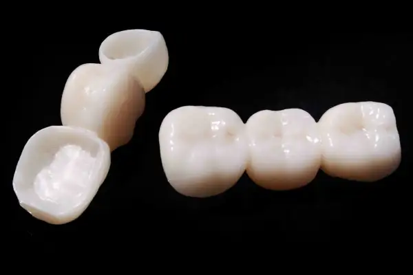Prótesis dentales de bopt dental, un puente de tres coronas y una corona individual, sobre fondo negro.