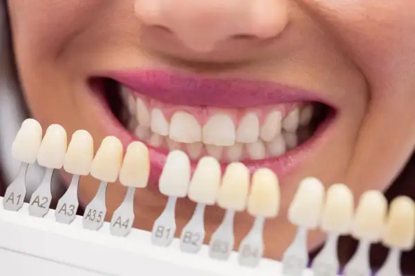 Una persona sonríe mostrando una guía de colores para **dientes de porcelana**, eligiendo el tono perfecto para un nuevo look.